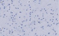 Anti-Dopamine Transporter Antibody, clone 1D2 ZooMAb Rabbit Monoclonal 