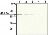 Anti-Doublecortin (N-terminal) antibody produced in rabbit 