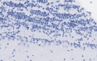 Anti-Doublecortin Antibody, clone 3F11 ZooMAb Rabbit Monoclonal 