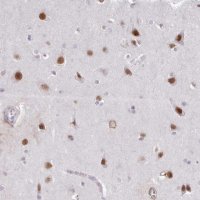 Anti-DPF1 antibody produced in rabbit 