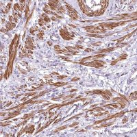 Anti-DPP3 antibody produced in rabbit 