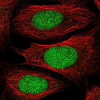 Anti-DPPA2 antibody produced in rabbit 