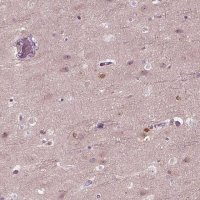 Anti-DPYSL5 antibody produced in rabbit 