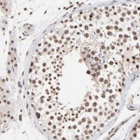 Anti-DSN1 antibody produced in rabbit 
