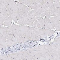 Anti-DSP antibody produced in rabbit 