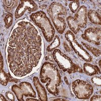 Anti-DSTYK antibody produced in rabbit 