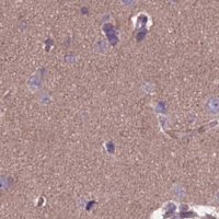 Anti-DUS2 antibody produced in rabbit 