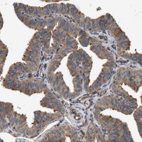 Anti-DUSP14 antibody produced in rabbit HPA019911-100UL