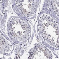 Anti-DUSP15 antibody produced in rabbit 