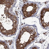 Anti-DYDC1 antibody produced in rabbit 
