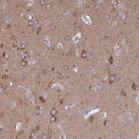 Anti-DYNC1I1 antibody produced in rabbit 