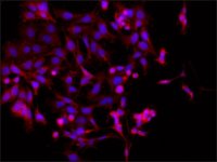 Anti-Dysbindin (C-terminal) antibody produced in rabbit SAB4200486-200UL