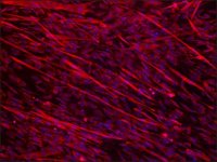 Anti-Dysferlin (N-terminal region) antibody produced in rabbit SAB4200388-200UL
