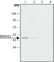 Anti-DYX1C1 antibody produced in rabbit 