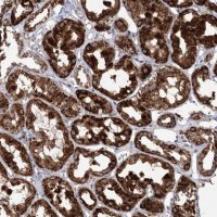 Anti-ECHDC3 antibody produced in rabbit 