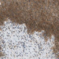Anti-EDARADD antibody produced in rabbit 