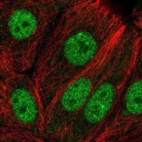 Anti-EFCAB6 antibody produced in rabbit 