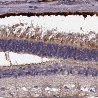 Anti-EFEMP1 antibody produced in rabbit 