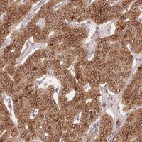 Anti-EI24 antibody produced in rabbit HPA051029-100UL