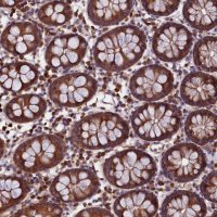 Anti-EIF3G antibody produced in rabbit 