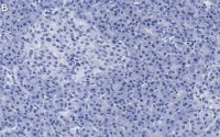 Anti-eIF3h Antibody, clone 2B15 ZooMAb Rabbit Monoclonal 