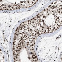 Anti-EIF4A3 antibody produced in rabbit 