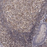 Anti-ELK3 antibody produced in rabbit 