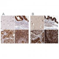 Anti-EML4 antibody produced in rabbit 