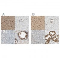 Anti-ENDOD1 antibody produced in rabbit 