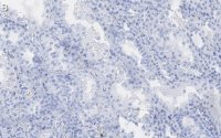 Anti-Endoglin Antibody, clone 1I15 ZooMAb Rabbit Monoclonal 