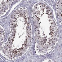 Anti-EP400NL antibody produced in rabbit 