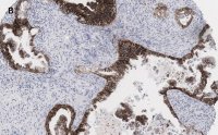 Anti-EpCAM Antibody, clone 1B8 , ZooMAb Rabbit Monoclonal 