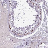 Anti-EPOP antibody produced in rabbit 