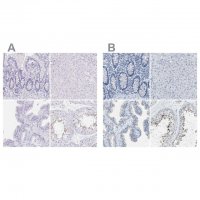 Anti-EQTN antibody produced in rabbit HPA015504-100UL
