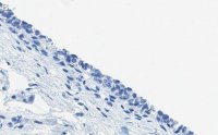 Anti-ErbB2/HER-2 Antibody, clone 1B13 ZooMAb Rabbit Monoclonal 