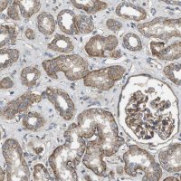 Anti-ERC1 antibody produced in rabbit 