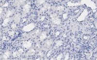 Anti-Erythropoietin Antibody, clone 6E5, ZooMAb Rabbit Monoclonal 