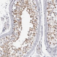 Anti-ESPN antibody produced in rabbit 