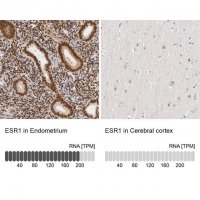 Anti-ESR1 antibody produced in rabbit 