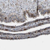 Anti-ESYT1 antibody produced in rabbit HPA016858-100UL
