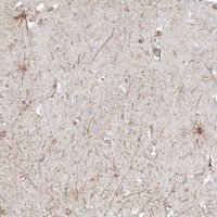 Anti-ETAA1 antibody produced in rabbit 