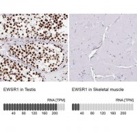 Anti-EWSR1 antibody produced in rabbit HPA051771-100UL