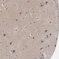 Anti-EXOSC10 antibody produced in rabbit HPA028470-100UL