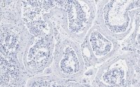 Anti-EZHIP/CXorf67 Antibody, clone 1J8 ZooMAb Rabbit Monoclonal 