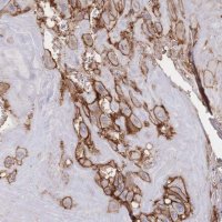 Anti-F11R antibody produced in rabbit 