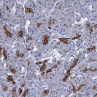 Anti-FAAP20 antibody produced in rabbit 