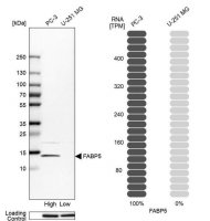 Anti-FABP5 antibody produced in rabbit 
