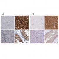 Anti-FAH antibody produced in rabbit 