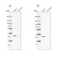 Anti-FAHD1 antibody produced in rabbit 