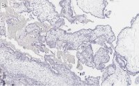 Anti-FAK Antibody, clone 1D14 ZooMAb Rabbit Monoclonal 